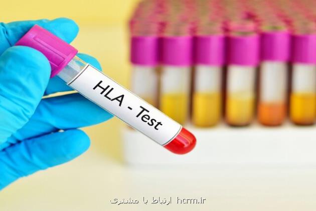 ضرورت توجه به قومیت ها برای تقویت بانک اطلاعاتی HLA جهت پیوند سلول های بنیادی